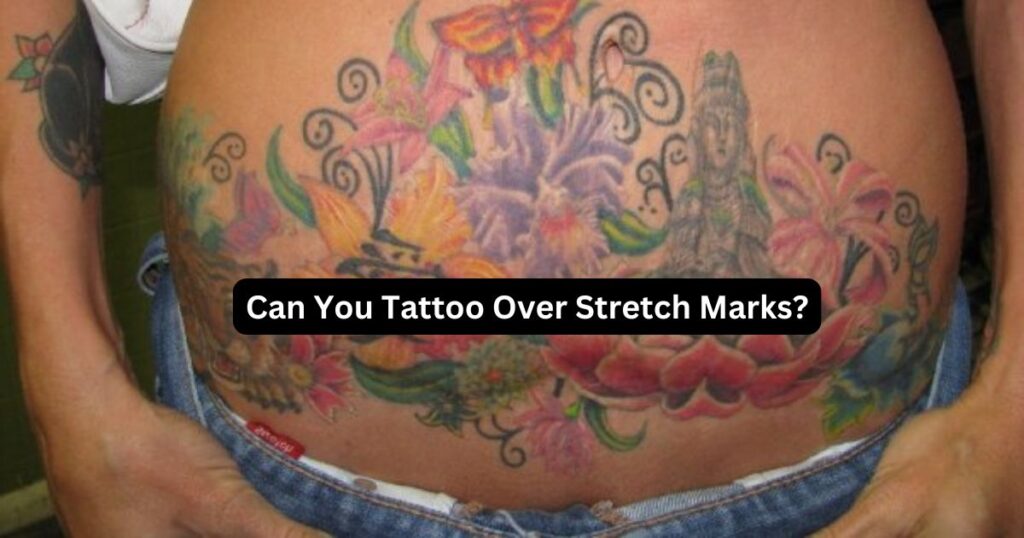 Can You Tattoo Over Stretch Marks